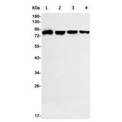 ACAP2 rabbit monoclonal antibody
