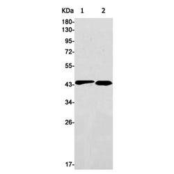 ACAT1 rabbit monoclonal antibody