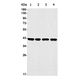 ACKR3 rabbit monoclonal antibody