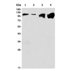 ACLY rabbit monoclonal antibody