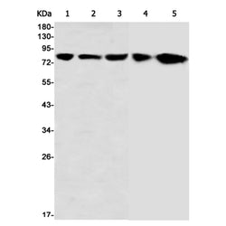 ACO2 rabbit monoclonal antibody