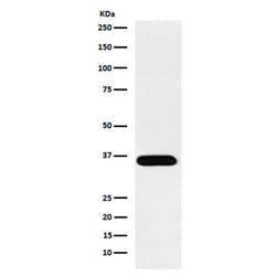 ACP5 rabbit monoclonal antibody