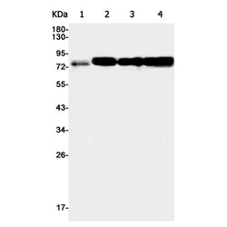 ACSL4 rabbit monoclonal antibody