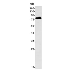 ACSS2 rabbit monoclonal antibody