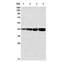 ACTA1 rabbit monoclonal antibody