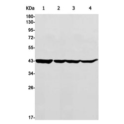 ACTA2 rabbit monoclonal antibody