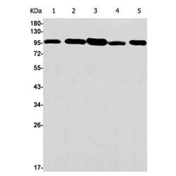 ACTN4 rabbit monoclonal antibody