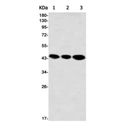 ACTR2 rabbit monoclonal antibody
