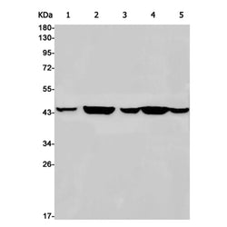 ACTR3 rabbit monoclonal antibody