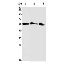 ACVR1 rabbit monoclonal antibody