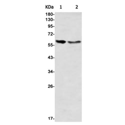 ACVR2B rabbit monoclonal antibody