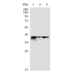 ADH5 rabbit monoclonal antibody