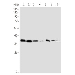 ADK rabbit monoclonal antibody
