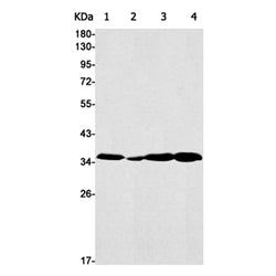 ADORA1 rabbit monoclonal antibody