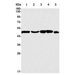 ADSS2 rabbit monoclonal antibody