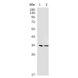 AIMP1 rabbit monoclonal antibody