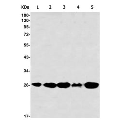 AK2 rabbit monoclonal antibody