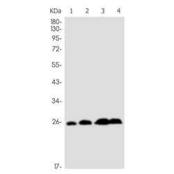AK4 rabbit monoclonal antibody