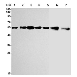 AKT1/AKT2/AKT3 rabbit monoclonal antibody