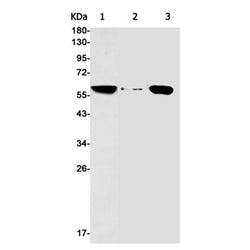 AKT3 rabbit monoclonal antibody