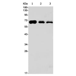 ALAS2 rabbit monoclonal antibody