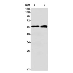 ALDH1A1 rabbit monoclonal antibody