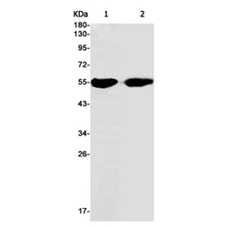 ALDH2 rabbit monoclonal antibody