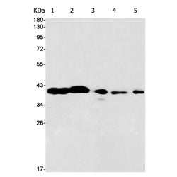 ALDOA rabbit monoclonal antibody