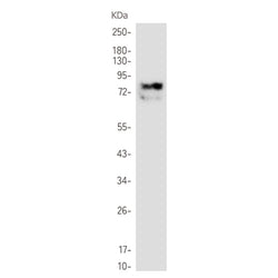 ALOX5 rabbit monoclonal antibody