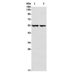 ANGPTL4 rabbit monoclonal antibody