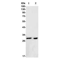 ANP32B rabbit monoclonal antibody