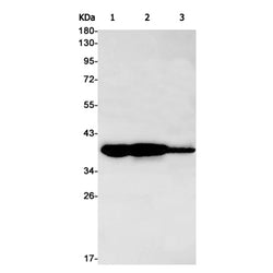 ANXA2 rabbit monoclonal antibody