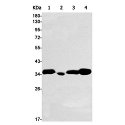 ANXA5 rabbit monoclonal antibody