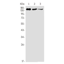 APC rabbit monoclonal antibody