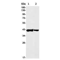 APTX rabbit monoclonal antibody