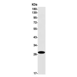 AQP1 rabbit monoclonal antibody