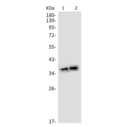 AQP2 rabbit monoclonal antibody