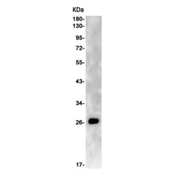 AQP5 rabbit monoclonal antibody