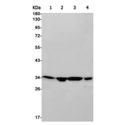 ARPC2 rabbit monoclonal antibody