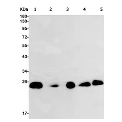 ARTN rabbit monoclonal antibody