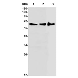 ASNS rabbit monoclonal antibody
