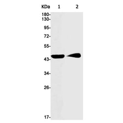 ASS1 rabbit monoclonal antibody
