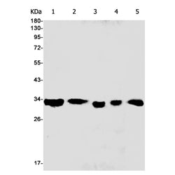ATF5 rabbit monoclonal antibody