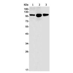 ATP2A2 rabbit monoclonal antibody