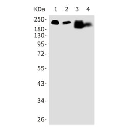 ATP2B1 rabbit monoclonal antibody