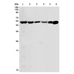 ATP5F1B rabbit monoclonal antibody