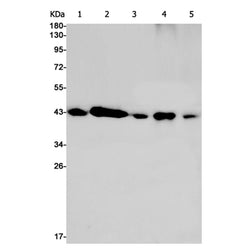 ATP6V0D1 rabbit monoclonal antibody