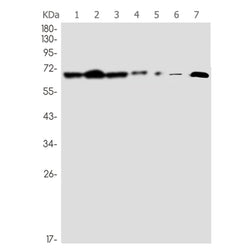 ATP6V1A rabbit monoclonal antibody