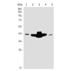 ATXN3 rabbit monoclonal antibody