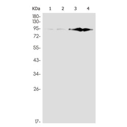 BAP1 rabbit monoclonal antibody